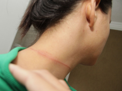 Linha com cerol causa ferimento em mulher de moto no Leblon